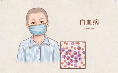 嬰兒白血病是怎么引起的，來自一位白血病女嬰父親的親述！